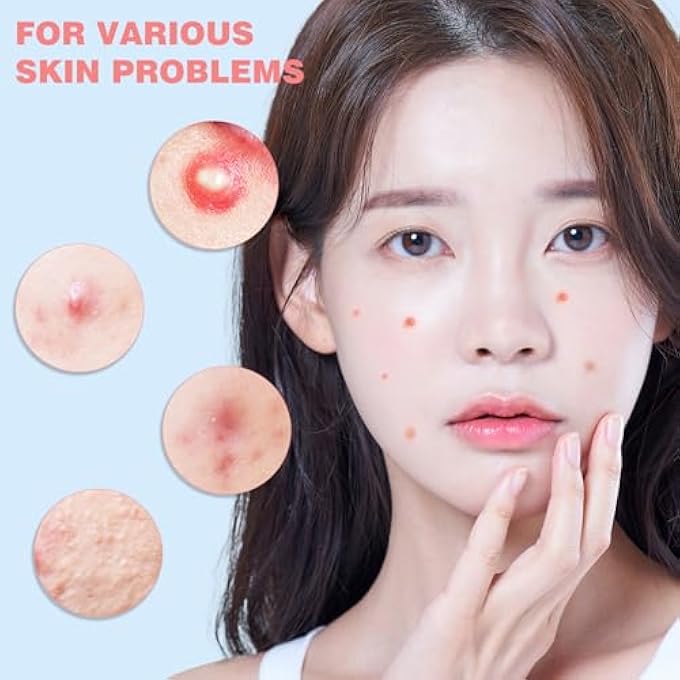 HLOES PIMPLE PATCHES FOR FACE 279PCS, HYDROCOLLOID ACNE PATCHES FOR COVERING ZITS AND BLEMISHES, CUTE STAR PIMPLE PATCHES, FACIAL SKIN CARE PRODUCTS. - Image 3